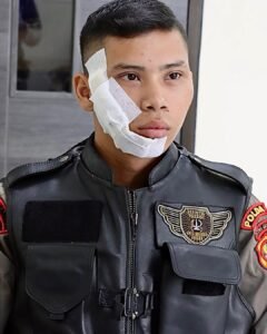 Polisi Tangkap Pelaku Penyiraman Air Keras di Jakarta Barat