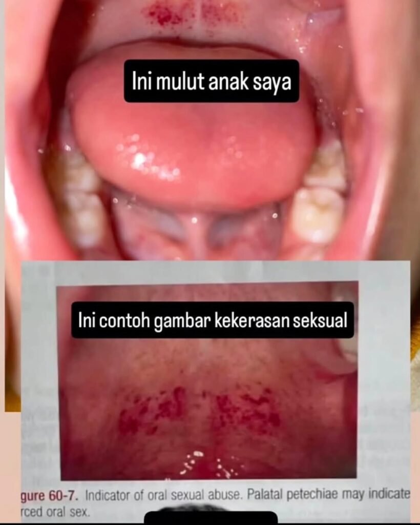 Miris! Seorang Balita jadi Korban Pelecehan Seksual di Balikpapan