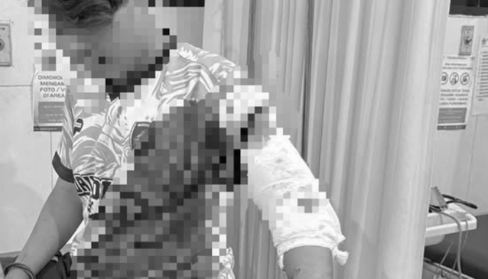 Teror Gangster Kembali Terjadi di Gresik, 1 Orang Dibacok