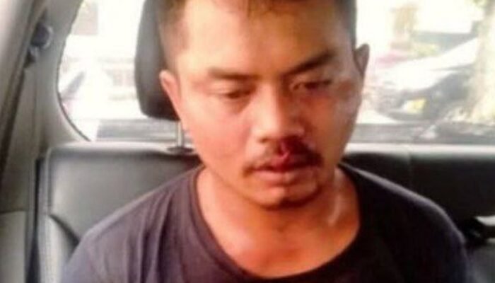 Keji! Ayah di Banjarnegara Tusuk dan Sayat Leher Anak Kandungnya Sendiri