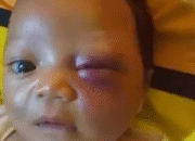 Tragis! Bayi 2 Bulan Dianiaya Ayah Kandung di Lombok Barat