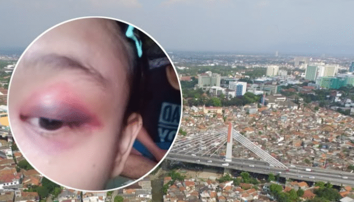 Dihina dan Dipukul, Remaja di Bandung Laporkan Mantan Pacar
