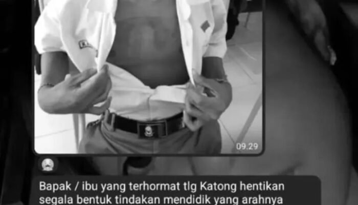 Diduga Disetrika Guru, Siswa SRMA 40 Ambon Alami Luka Bakar di Dada