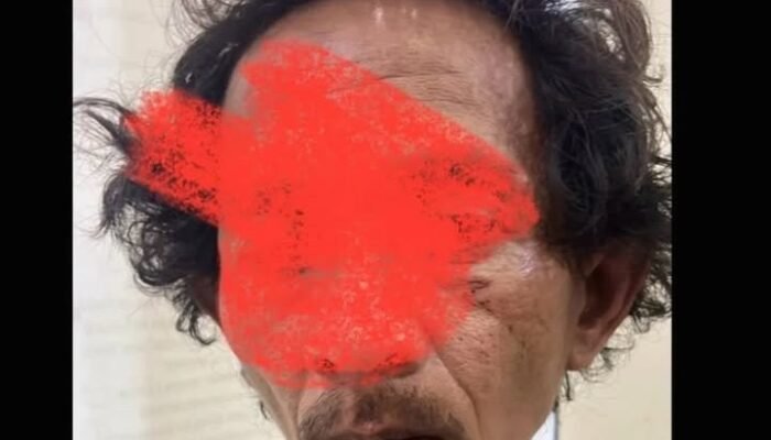 Dugaan Pencabulan di Pademangan, Pelaku Setubuhi Anak Kandung hingga Hamil