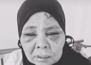 Protes Penambangan di Lahannya, Nenek di Pasaman jadi Korban Penganiayaan