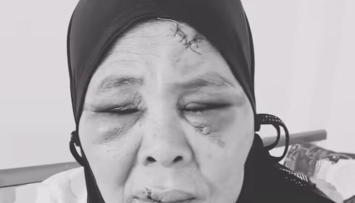 Protes Penambangan di Lahannya, Nenek di Pasaman jadi Korban Penganiayaan