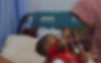 Tragis! Balita di Karawang Dianiaya Pacar Ibu hingga Alami Kebutaan