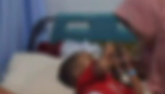 Tragis! Balita di Karawang Dianiaya Pacar Ibu hingga Alami Kebutaan