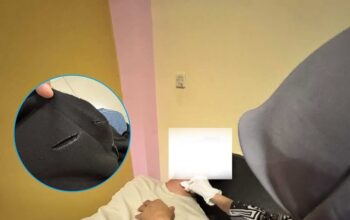 Terjerat Benang Gelasan, Pengendara Motor Alami Luka di Leher