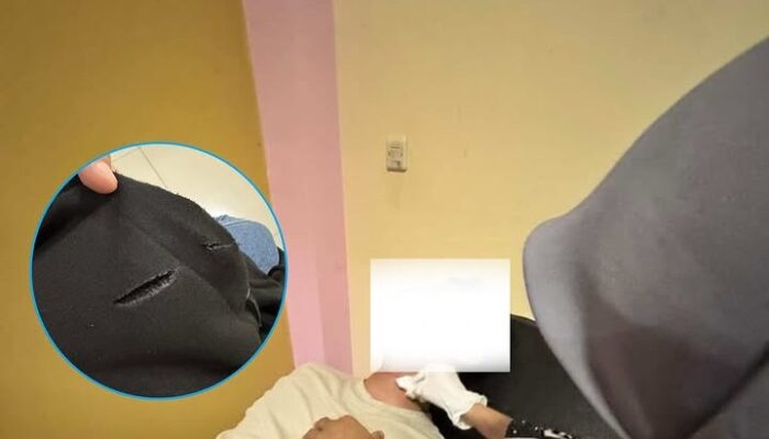 Terjerat Benang Gelasan, Pengendara Motor Alami Luka di Leher