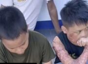 Kasus Pembakaran 3 Santri di Lombok Tengah Masuk Tahap Penyidikan, 1 Korban Meninggal