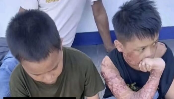 Kasus Pembakaran 3 Santri di Lombok Tengah Masuk Tahap Penyidikan, 1 Korban Meninggal