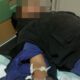 Tragis! Tangan Pelajar Putus usai Tawuran di Klari Karawang