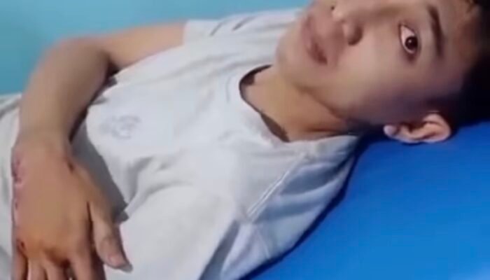 Pulang Kerja Dini Hari, Pekerja Jadi Korban Begal di Jalur Kosambi-Telagasari